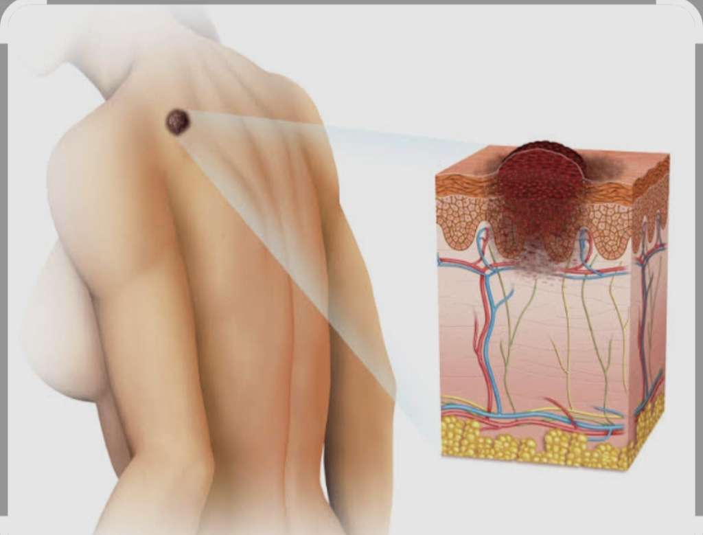 l_aab73c52949d79d68c3d6ba4595ba53a