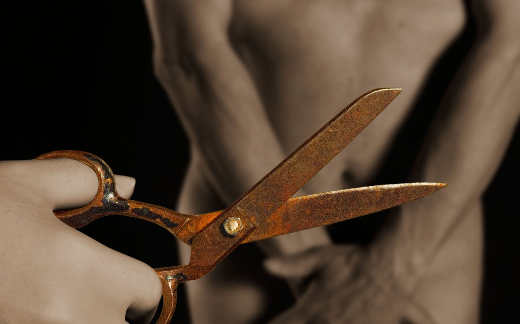 vazektomija sterilizacija