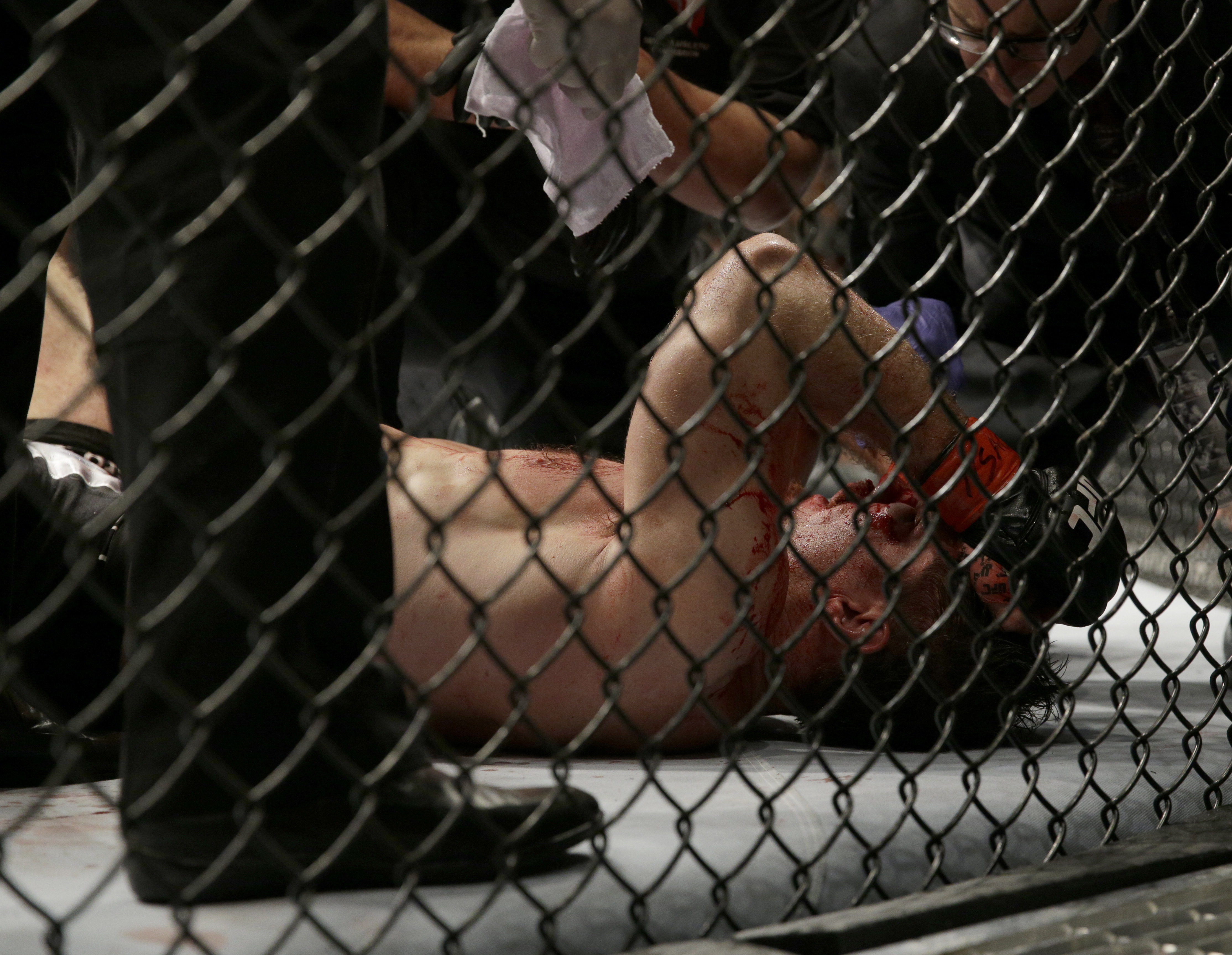 Tim Kennedy after his fight with Yoel Romero, Saturday, Sept. 27, 2014, in Las Vegas. Romero won via TKO. (AP Photo/John Locher)