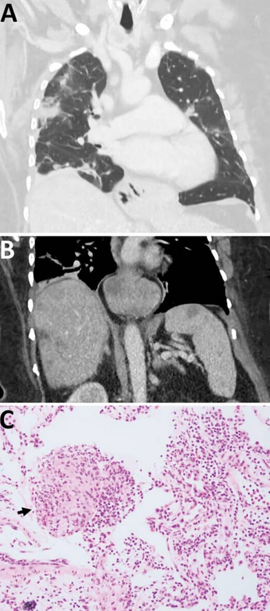 Screenshot 2026-03-01 123326