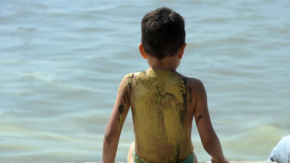 bacice_zutilo13-120415