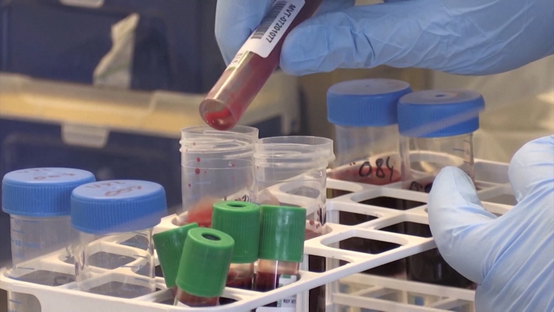 BG-VAKCINA VUCIC PKG-19-SOS(20201215-175001072).mxf.158_08.Still002