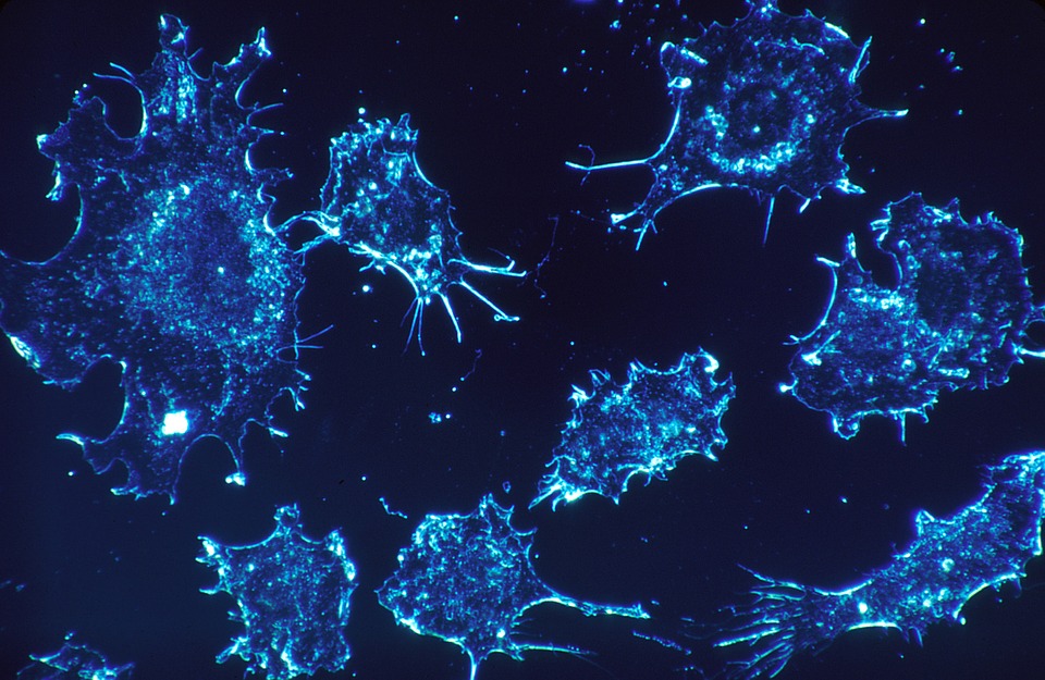cancer-cells-541954_960_720