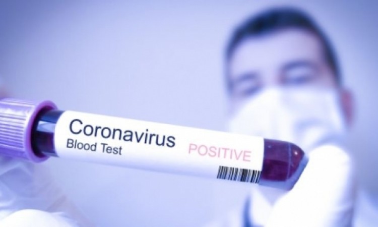 coronavirus