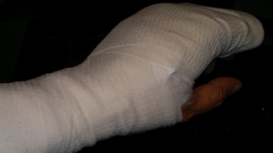 gips