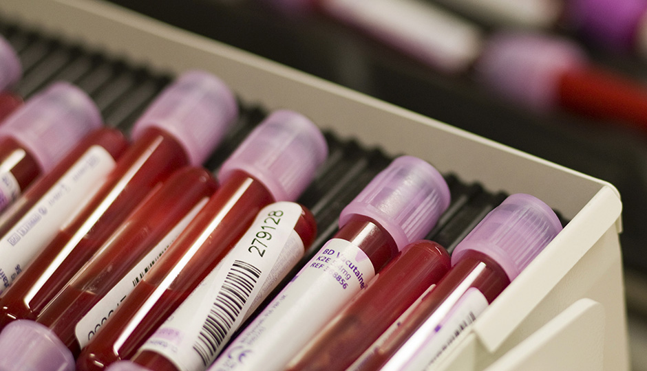 hepatitis foto REUTERS Valentin Flauraud