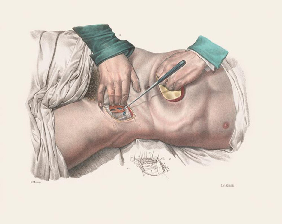 Image © Wellcome Collection