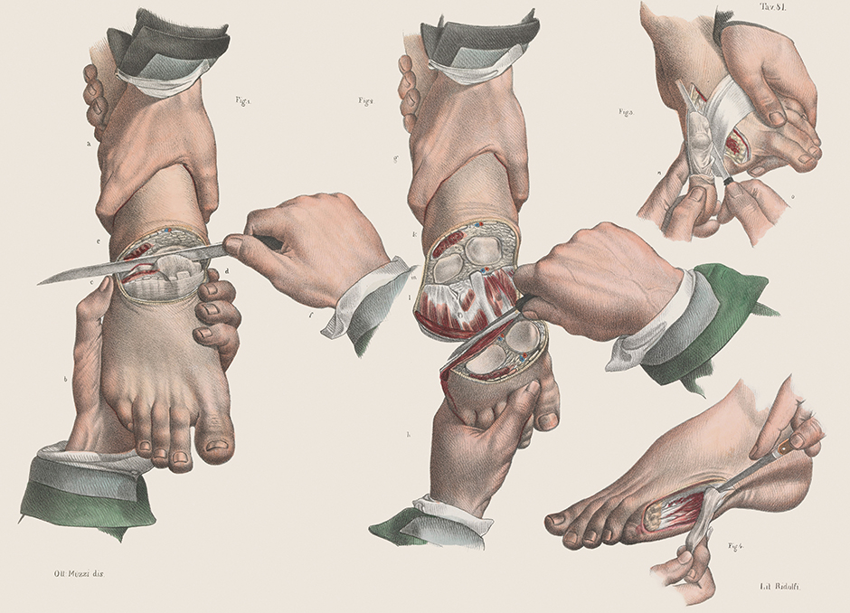 Image © Wellcome Collection