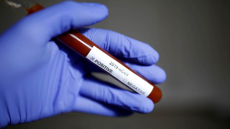 Koronavirus, Korona virus, korona, virus