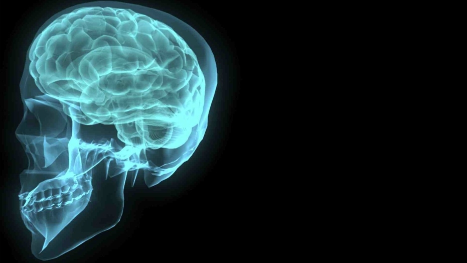 mozak glava rendgen (freeimages obscenity)