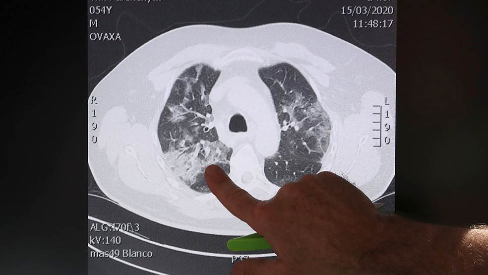 REUTERS Yves Hermans