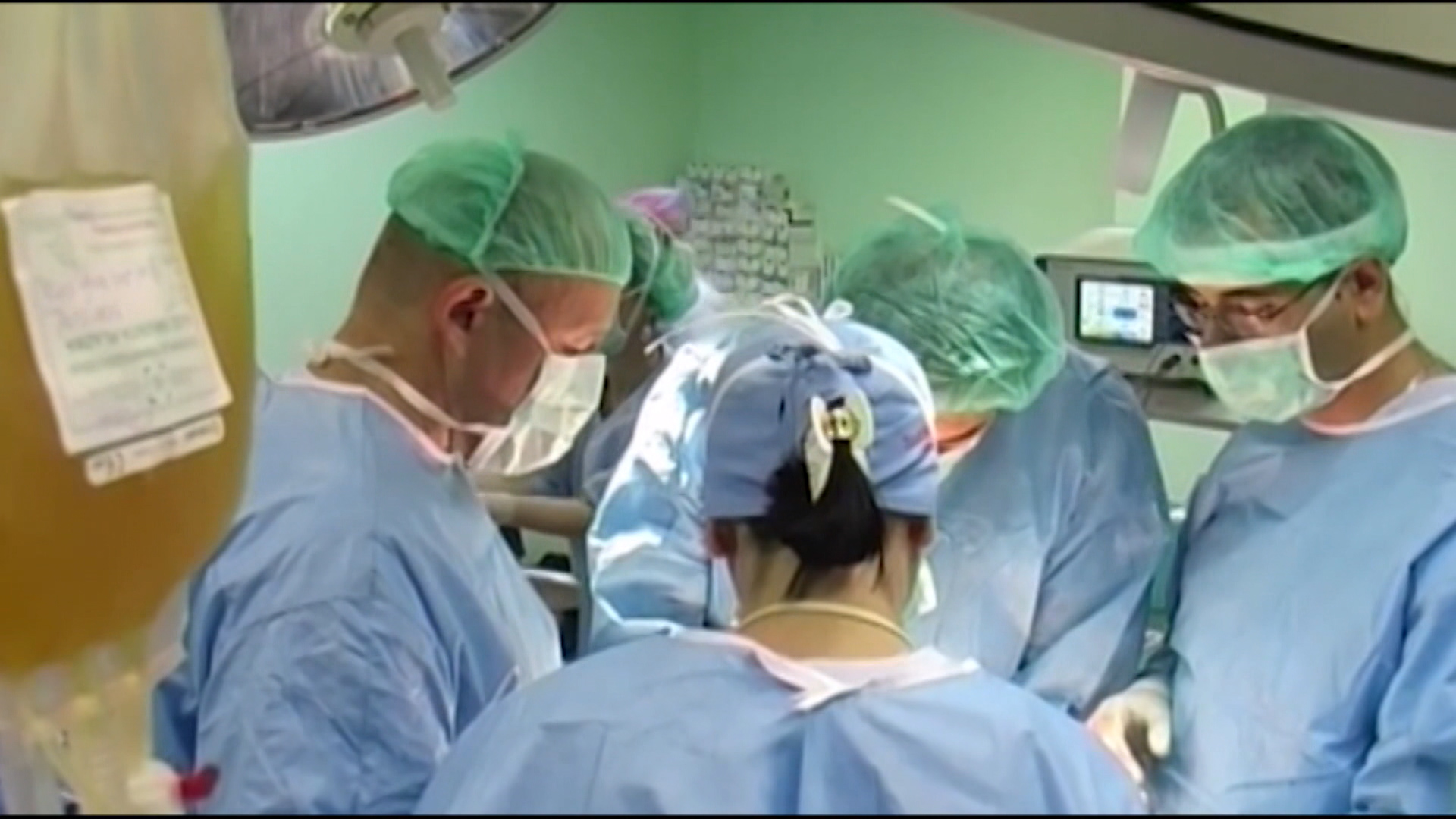 SA-TRANSPLANTACIJE PKG-NAT-1(20191019-175623209).00_00_48_05.Still002