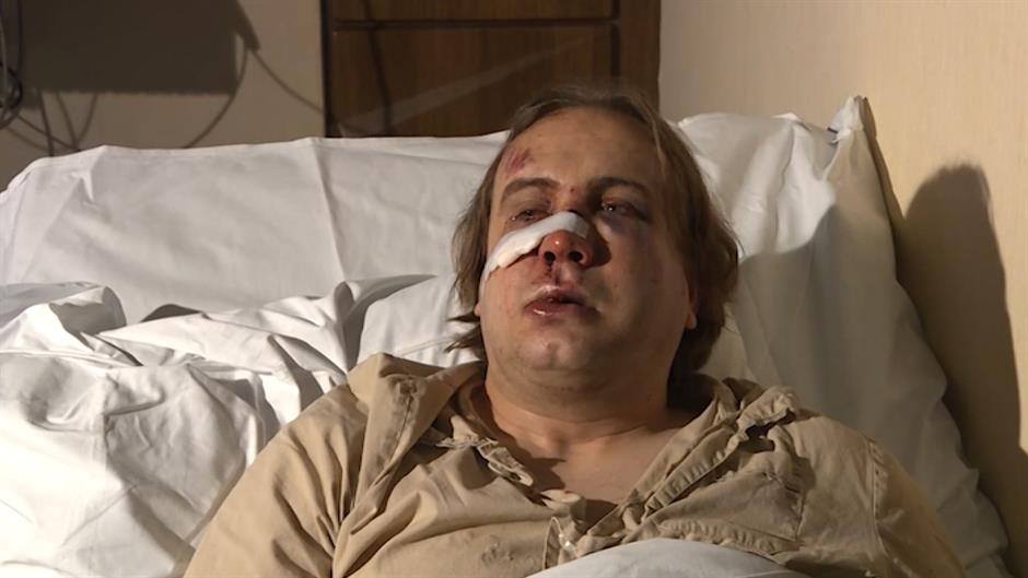 snimatelj pretučen 2 anadolija