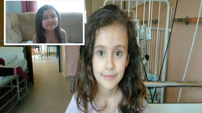 thumbnail_Selma prije i poslije