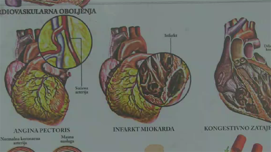 začepljenje arterija