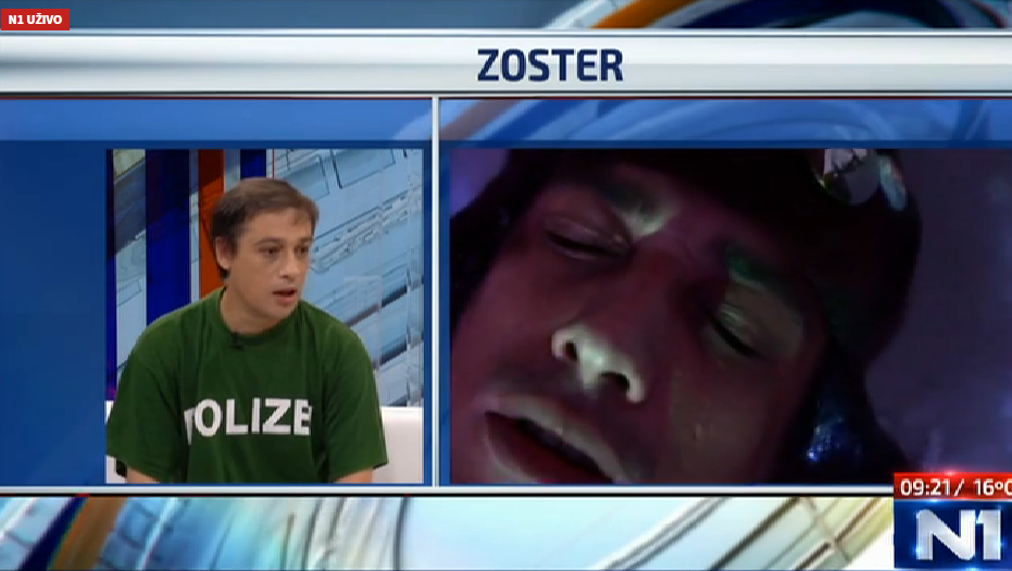zoster1